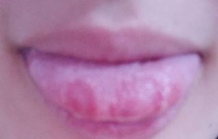 吃小白瓜舌头麻,揭秘小白瓜的独特口感之谜